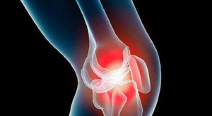 Лечение коленного сустава тольятти thumbnail